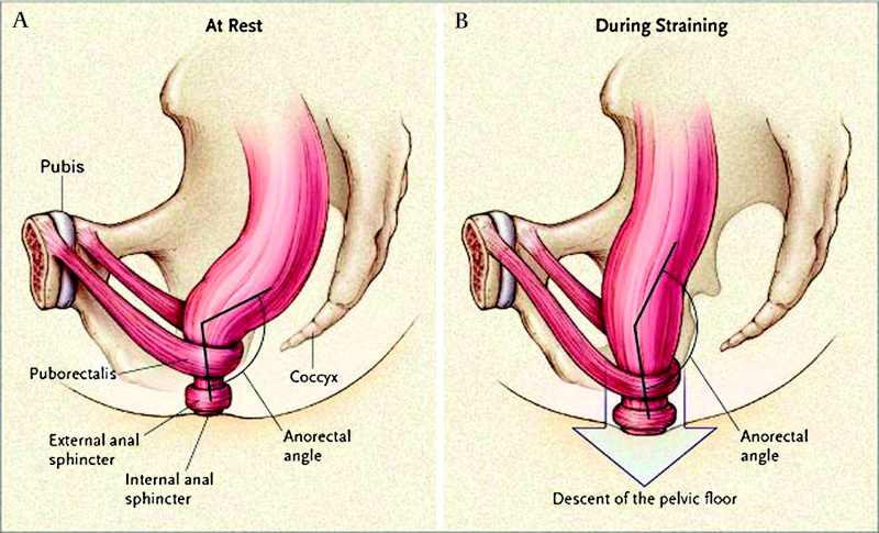 Anatomy puborectalis