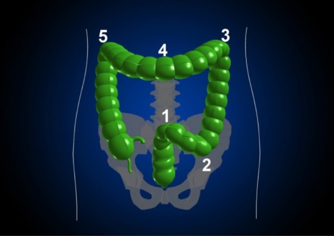 Anatomy RSJ