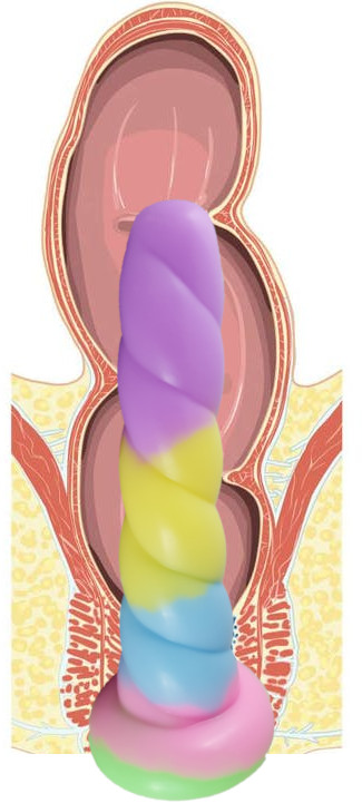 Warmup rectum folds